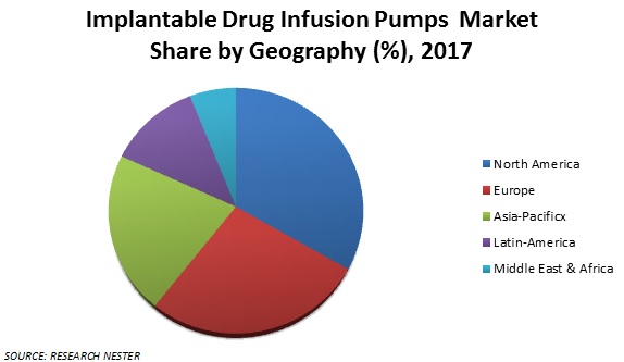 Implantable Drug Infusion Pumps  Market share